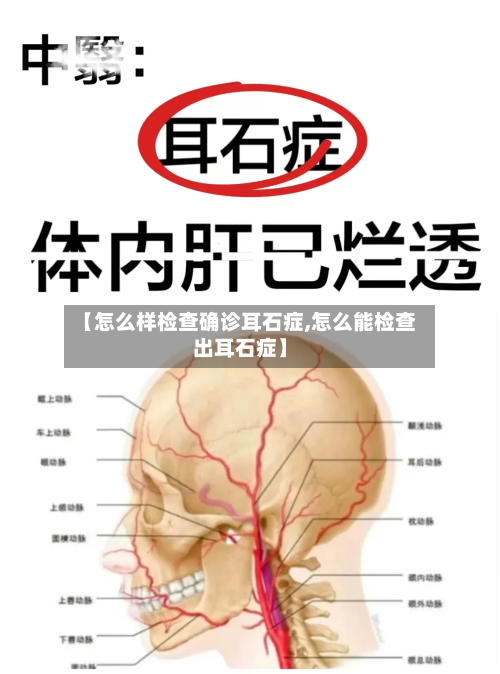 【怎么样检查确诊耳石症,怎么能检查出耳石症】