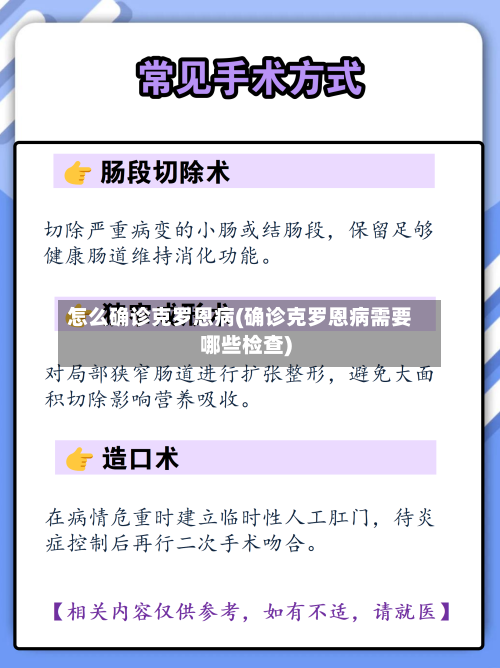 怎么确诊克罗恩病(确诊克罗恩病需要哪些检查)-第2张图片
