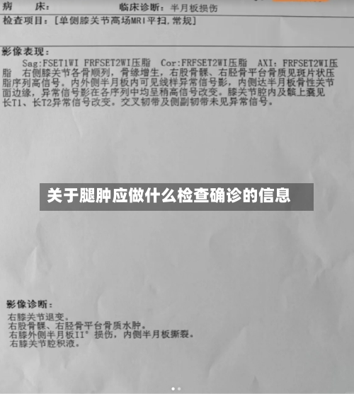 关于腿肿应做什么检查确诊的信息-第2张图片
