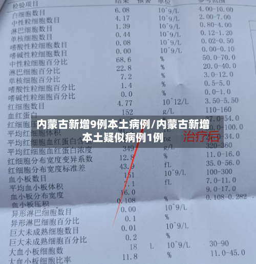 内蒙古新增9例本土病例/内蒙古新增本土疑似病例1例