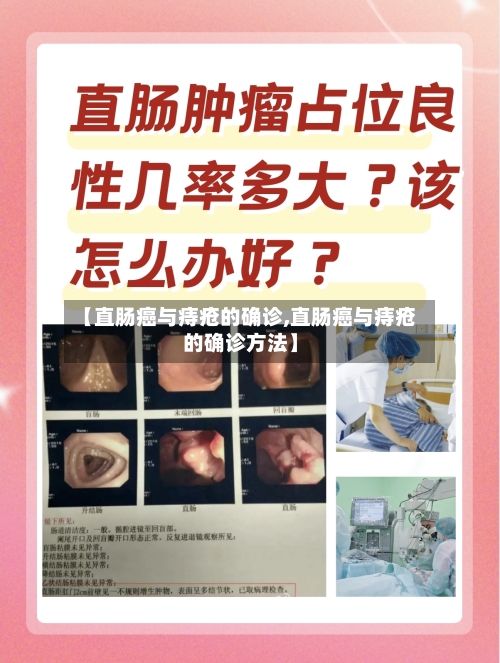 【直肠癌与痔疮的确诊,直肠癌与痔疮的确诊方法】-第2张图片