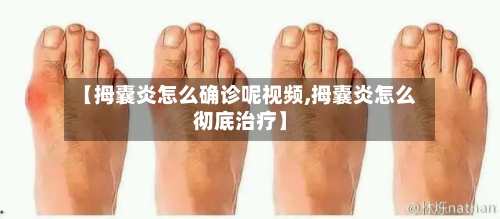 【拇囊炎怎么确诊呢视频,拇囊炎怎么彻底治疗】-第2张图片