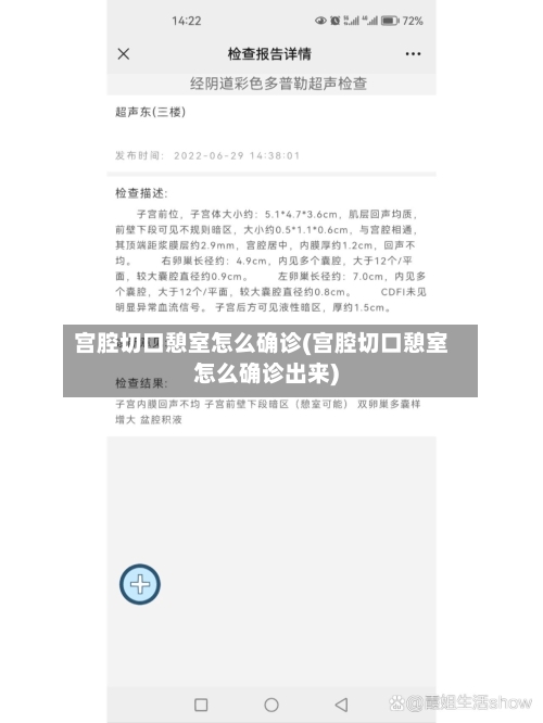 宫腔切口憩室怎么确诊(宫腔切口憩室怎么确诊出来)-第2张图片